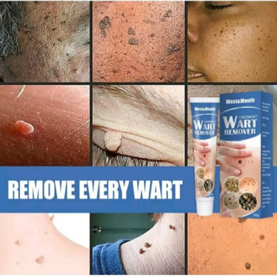 HỘP KEM BÔI TRỊ HẾT MỤN CÓC NÚT RUỒI DA ĐEN SẠM THUẬN TIỆN CHO MỌI NGƯỜI