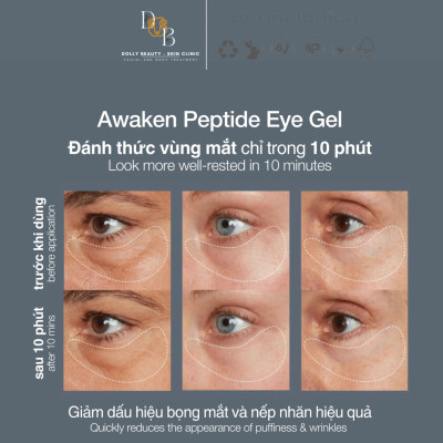 [DERMALOGICA] Kem dưỡng mắt dạng gel giúp mắt khoẻ AWAKEN PEPTIDE EYE GEL đánh thức vùng mắt từ sâu bên trong