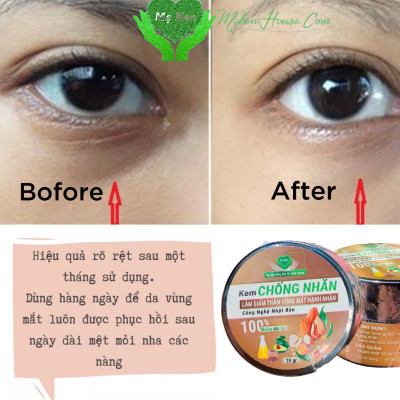 KEM CHỐNG NHĂN, LÀM GIẢM THÂM VÙNG MẮT HẠNH NHÂN MẸ KEN