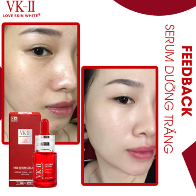 Serum Dưỡng Trắng - Tái Tạo - Trẻ Hóa Da VK II ( 15ml/35ml )
