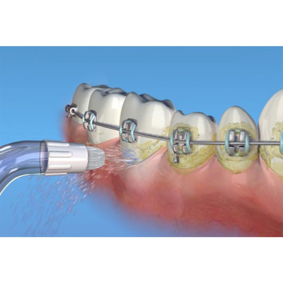 Máy tăm nước không dây giúp vệ sinh răng miệng Waterpik Cordless WP450