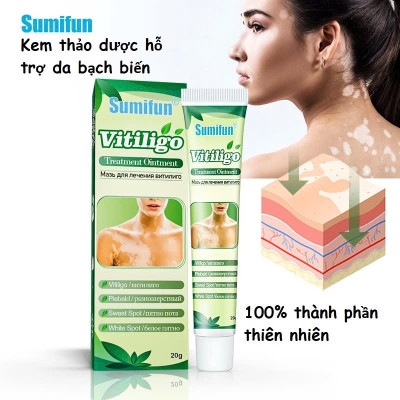 [Vilitigo] Kem Bôi Lang Ben, Hắc Lào, Nấm Ngứa, Vẩy Nến – Chiết Xuất Thảo Dược An Toàn