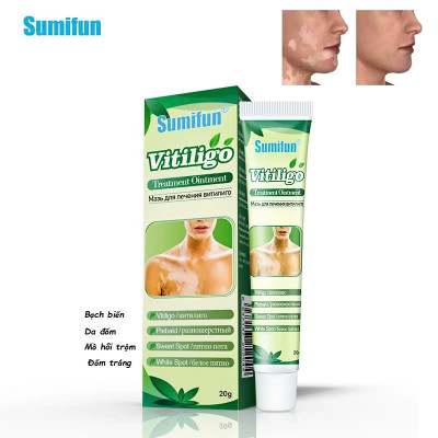 [Vilitigo] Kem Bôi Lang Ben, Hắc Lào, Nấm Ngứa, Vẩy Nến – Chiết Xuất Thảo Dược An Toàn