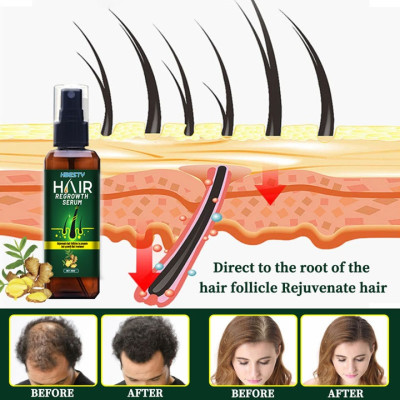 Serum dưỡng mọc tóc, giúp tóc mọc nhanh, nhiều và dày, sợi tóc đen bóng xuất xứ Nhật Bản – Mã số 1230