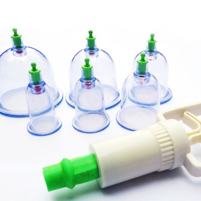 Bộ Dụng Cụ Giác Hơi Không Dùng Lửa 12 Ly - Hàng Nhập Khẩu